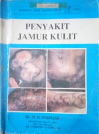 Image of Penyakit Jamur Kulit