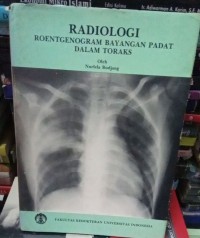 Image of Radiologi Roentgenogram Bayangan Padat Dalam Toraks